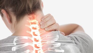 Come trattare l'osteocondosi della colonna cervicale