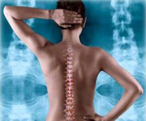 Illustrazione della colonna vertebrale posteriore