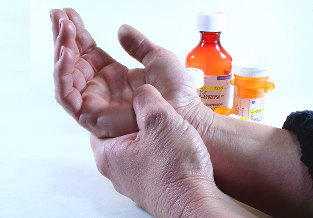 Metodi di trattamento dell'artrite e dell'osteoartrite