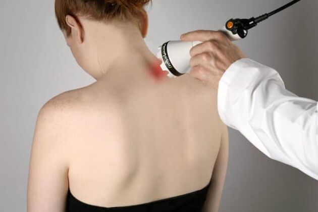 La terapia laser viene utilizzata per combattere il mal di schiena nella zona della scapola. 