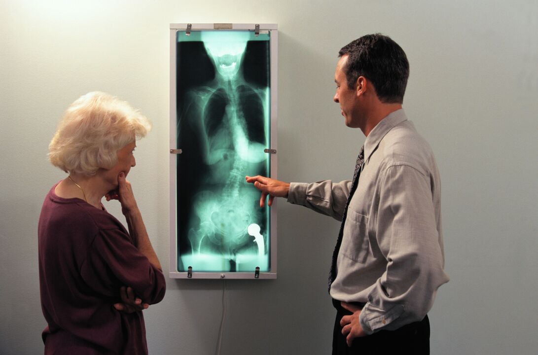 Diagnostica a raggi X per il dolore all'articolazione dell'anca